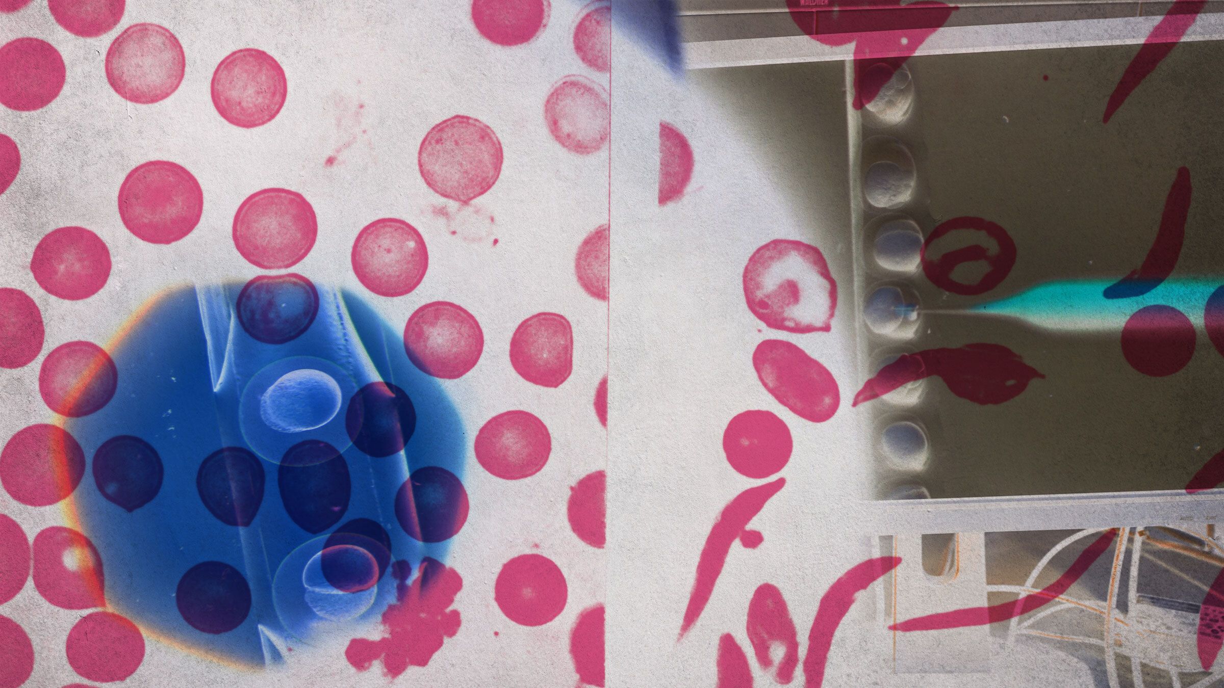 Gene Editing Needs to Be for Everyone